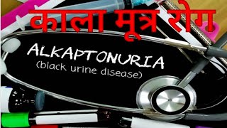 Alkaptonuria काला मूत्र रोग By Deepak Dewangan [upl. by Iinden265]