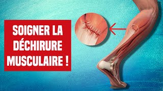 SOIGNER UNE DÉCHIRURE MUSCULAIRE  EXPLICATION ET TRAITEMENT [upl. by Eugene]