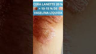 Excipiente emulsiones para psoriasis [upl. by Webber767]