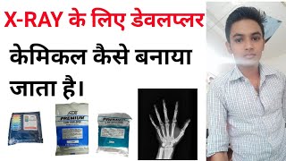 xray ke liye developer kaise banaya jata hai  how to make developer and fixer for xray in hindi [upl. by Mima]