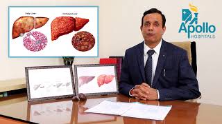 Liver diseases preventionprotection by Dr Shravan Bohra Liver Specialist at Apollo Ahmedabad [upl. by Sergius]