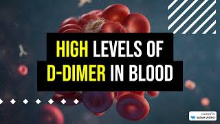 High levels of D dimer in blood 5 REASONS [upl. by Ocimad]