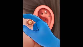 Infected ear treatment asmr [upl. by Langan]