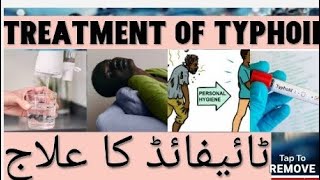 treatment of typhoid [upl. by Sulohcin428]