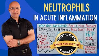 Neutrophils in Acute Injury  Hematology  Pathology [upl. by Jew]