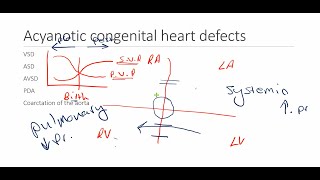 Acyanotic heart diseases [upl. by Eniar400]