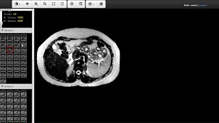 Web DICOM Viewer [upl. by Yllac]