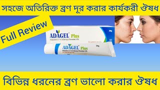 Adagel Plus Gel Adapalene Benzoyl Peroxide সহজে এবং দ্রুত ব্রণ ভালো করার ঔষধ সম্পর্কে আলোচনা [upl. by Eirbua927]