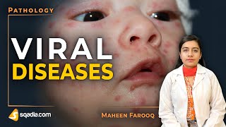 Viral Diseases  Smallpox  Pathology Video  Medical Education Channel  VLearning [upl. by Rafaela]