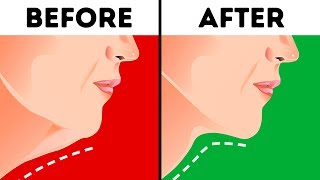 6 Effective Ways to Get Rid of a Double Chin [upl. by Ereveniug490]