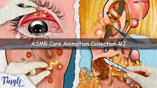 ASMR CARE ANIMATION COLLECTION 2  Eye Stone Ingrown Toenail Ear Piercing Big Armpit Ance [upl. by Etnoval182]