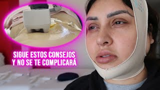 CÓMO SON LOS PRIMEROS 15 DIAS DESPUÉS DE UNA ABDOMINOPLASTIA Y LIPOESCULTURA TODOS LOS TIPS AQUÍ [upl. by Naneek]