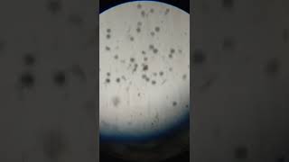 Microcystis Colony under microspore MSc Practical botany practical trendingshorts algae shorts [upl. by Solegnave592]