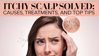 The Real Causes of Itchy Scalp—and How to Stop It [upl. by Everard]