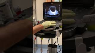 Bladder Scan Procedure [upl. by Steddman]