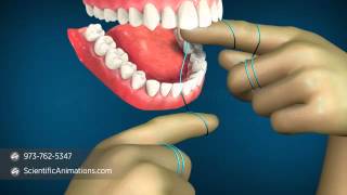 How to Floss Properly  Flossing Technique [upl. by Krueger]