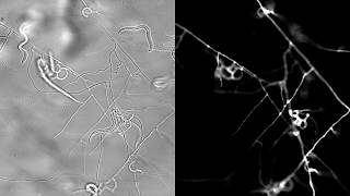 Arthrobotrys oligospora developing traps in respond to C elegans [upl. by Micky502]