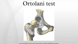 Ortolani test [upl. by Meeki]