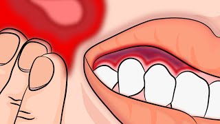 How to Stop your Toothache Pain INSTANTLY and Naturally [upl. by Malkin]