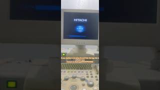 Hitachi EUB 7000 Ultra sound machine problem [upl. by Ellora108]