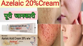 Skinoren 20 Cream eBay azelaic acid Treatment of Acne Usage Side Effects [upl. by Nylime]