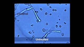 Medallion SC Fungicide Spores 2013 [upl. by Nibas]