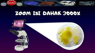 ZOOM ISI DAHAK DENGAN MIKROSKOP ELEKTRONSPUTUM UNDER MICROSCOPE  DIRGA BIOLOGY CHANNEL [upl. by Amethist]