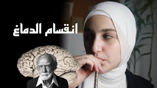 روجر سبيري و نظرية انقسام الدماغ Roger sperry and split brain research [upl. by Raybin]