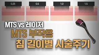 MTS 침길이별 효과 or 부작용  MTS 전문채널 NO1 MTS전도사 [upl. by Wylma]