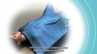 Sonata Fibroid Treatment Procedure Animation [upl. by Stephens131]