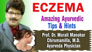 Eczema  Ayurvedic Remedies  Prof Dr Murali Manohar Chirumamilla MD Ayurveda [upl. by Merras]