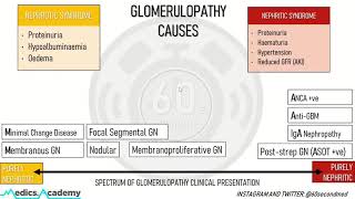 78 SECONDS on CAUSES of GLOMERULOPATHIES Finally get your head around this [upl. by Eimiaj935]