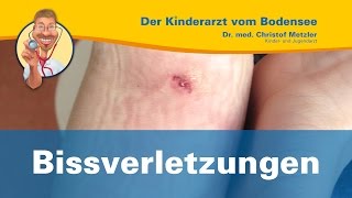 Bissverletzungen  Der Kinderarzt vom Bodensee [upl. by Sirapal]