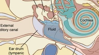 What Are Ear Tubes  Ear Problems [upl. by Annaed]