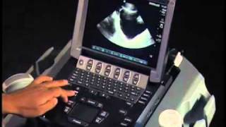 How To Ultrasound FAST Exam  Male Pelvis [upl. by Annaujat579]