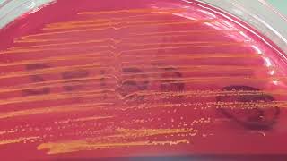 Leuconostoc mesenteroides growth on CLED agar of Urine Culture [upl. by Ecienaj]