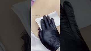 Cover up tattoo  Amazing stitching tattoo cover up  coveruptattoo [upl. by Harad]