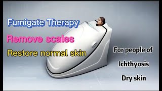 How to cure ichthyosisichthyosis ichthyosisvulgaris dryskin fishscale dermatologist [upl. by Lak]