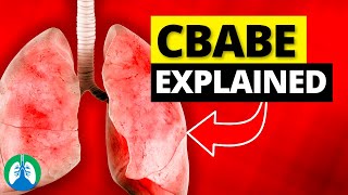 CBABE Explained Top 5 Obstructive Lung Diseases [upl. by Parik427]