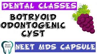 Botryoid Odontogenic Cyst NEET MDS CAPSULE mds dental neetmds oralpathology [upl. by Natal44]