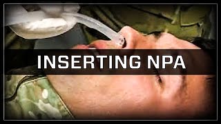 Inserting a Nasopharyngeal Airway NPA [upl. by Lindner543]