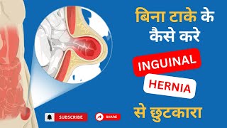 Inguinal Hernia  Signs And Symptoms Explain In Hindi  Dr Ankur Bansal [upl. by Stacie]