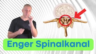 Spinalkanalstenose  Ursachen Symptome und Therapie [upl. by Adnawat72]