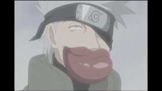 Face of Kakashi Funny  Kakashi unmasked [upl. by Igic285]