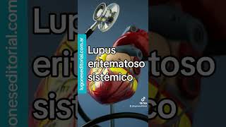 Morbilidad cardiovascular en lupus eritematoso sistémico [upl. by Oicnerolf]