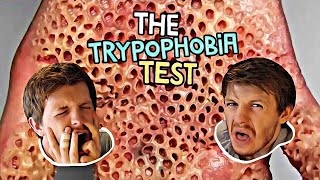 Trypophobia Test  The Phobia You Never Knew You Had [upl. by Akiria]