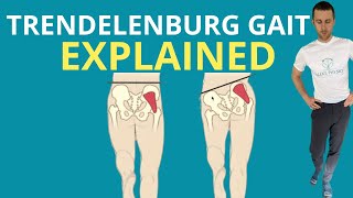 Trendelenburg Gait Explained [upl. by Lemuel]