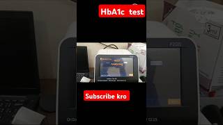 HbA1c test by SD BIOSENSER f200hba1csugarpathologymltmedicallaboratorymltlabtechnicianblood [upl. by Othe874]