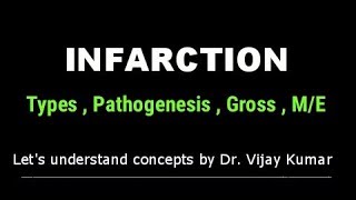 Infarction Pathology  Infarction Types  Infarction Morphology  Pathology Lectures [upl. by Dat672]