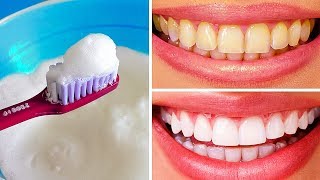 10 Natural Ways to Whiten Teeth at Home [upl. by Abernon]